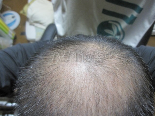 watermarked-2014-11-17-2