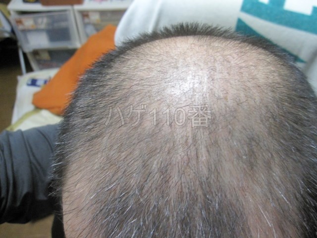 watermarked-2014-11-17-3